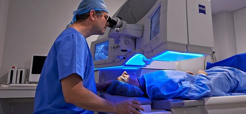 La correzione della visione laser non dura a lungo e ha un piccolo elenco di effetti collaterali